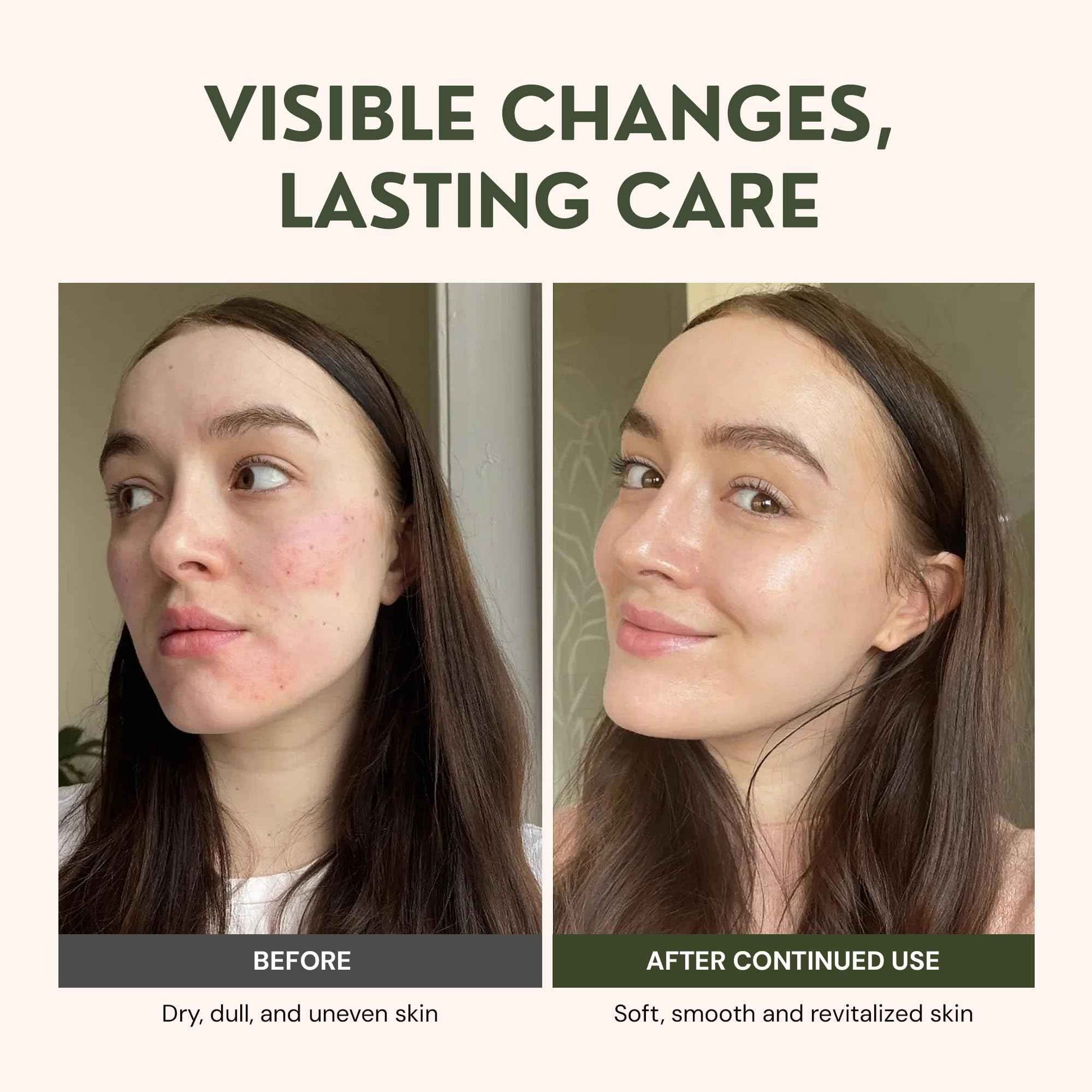 RAW ACTIVES Beef Tallow for Skin Care - 100% Grass Fed Grass Finished - with Organic Jojoba, Prickly Pear, Rosehip, Tamanu Oils, Neroli, Vanilla & Manuka Honey - 3oz