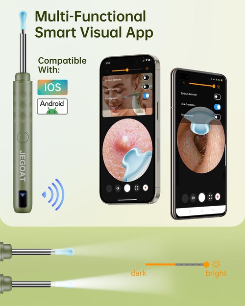 Ear Wax Removal Tool Camera, Ear Cleaner with Camera, Ear Cleaning Kit 1296P HD Ear Scope and 6 LED Lights, 10 Ear Pick Tips, Earwax Removal kit with Otoscope to Earify Earwax for iOS and Android