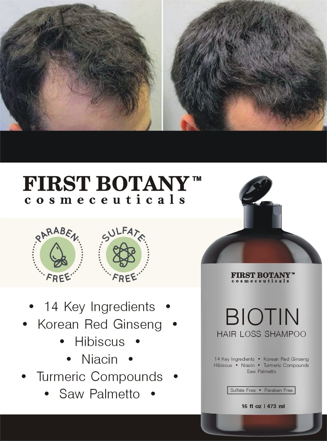 First Botany Cosmeceuticals, Hair Regrowth and Anti Hair Loss Shampoo 16 fl oz, with DHT blockers- Daily Hydrating, Detoxifying, Volumizing Shampoo For Men and Women