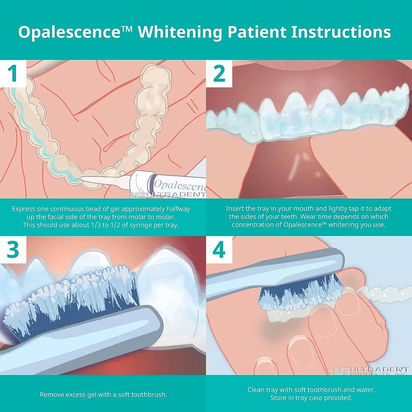 Opalescence 20% with PF Gel Syringes Teeth Whitening (2 Packs / 4 Syringes) Refill Kit Carbamide Peroxide. Made by Ultradent, in Melon Flavor. Tooth Whitening Refill Syringes 5401-2