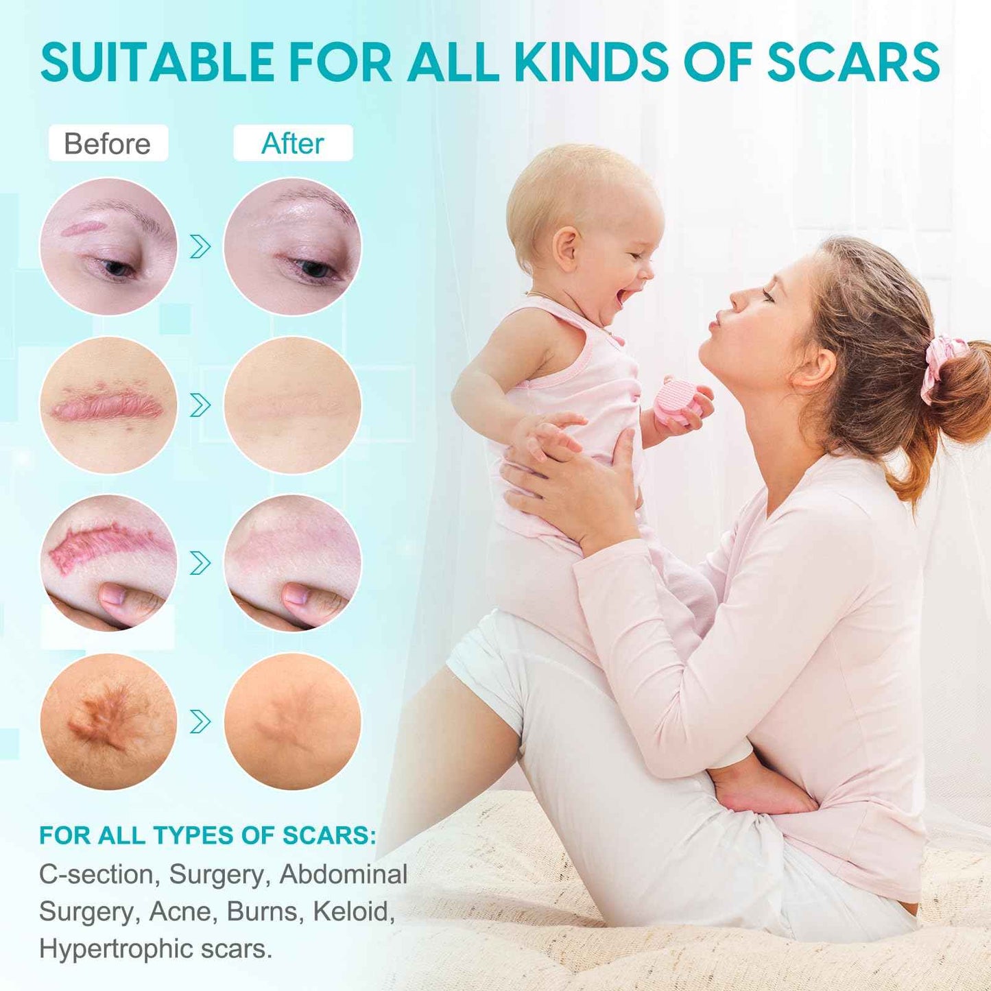 Silicone Scar Sheets (1.6” x 120”), Medical Grade Scar Tape for C-Section, Surgery, Keloid, Burn, Acne Scars - Reusable, Pain-Free, Safe for Sensitive Skin