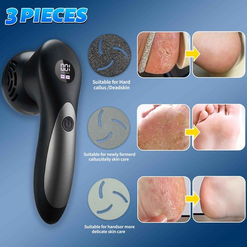 Doeean Electric Feet Foot Callus Remover Equipped with A Vacuum System Foot Scrubber 17 in 1 Professional Foot Care Tool Ipx6 Waterproof Rating for Removing Hard Cracks Dryness and Dead Skin (Black)