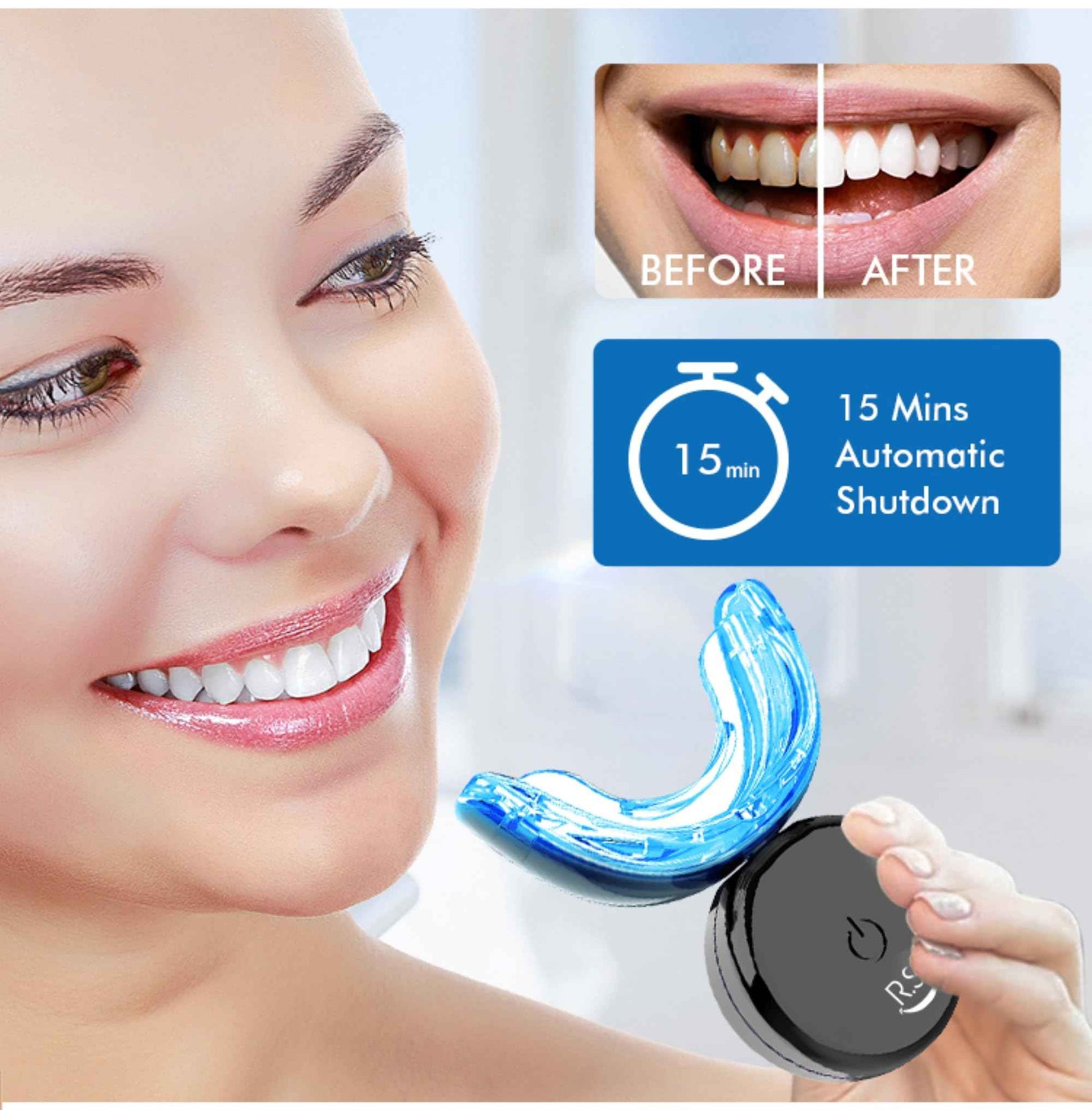 RS Smile Professional Wireless Teeth Whitening Kit with 32X Dual LED Lights, Red & Blue Light Technology for Deep Whitening, Rechargeable Device, Gentle Enamel - Safe Formula