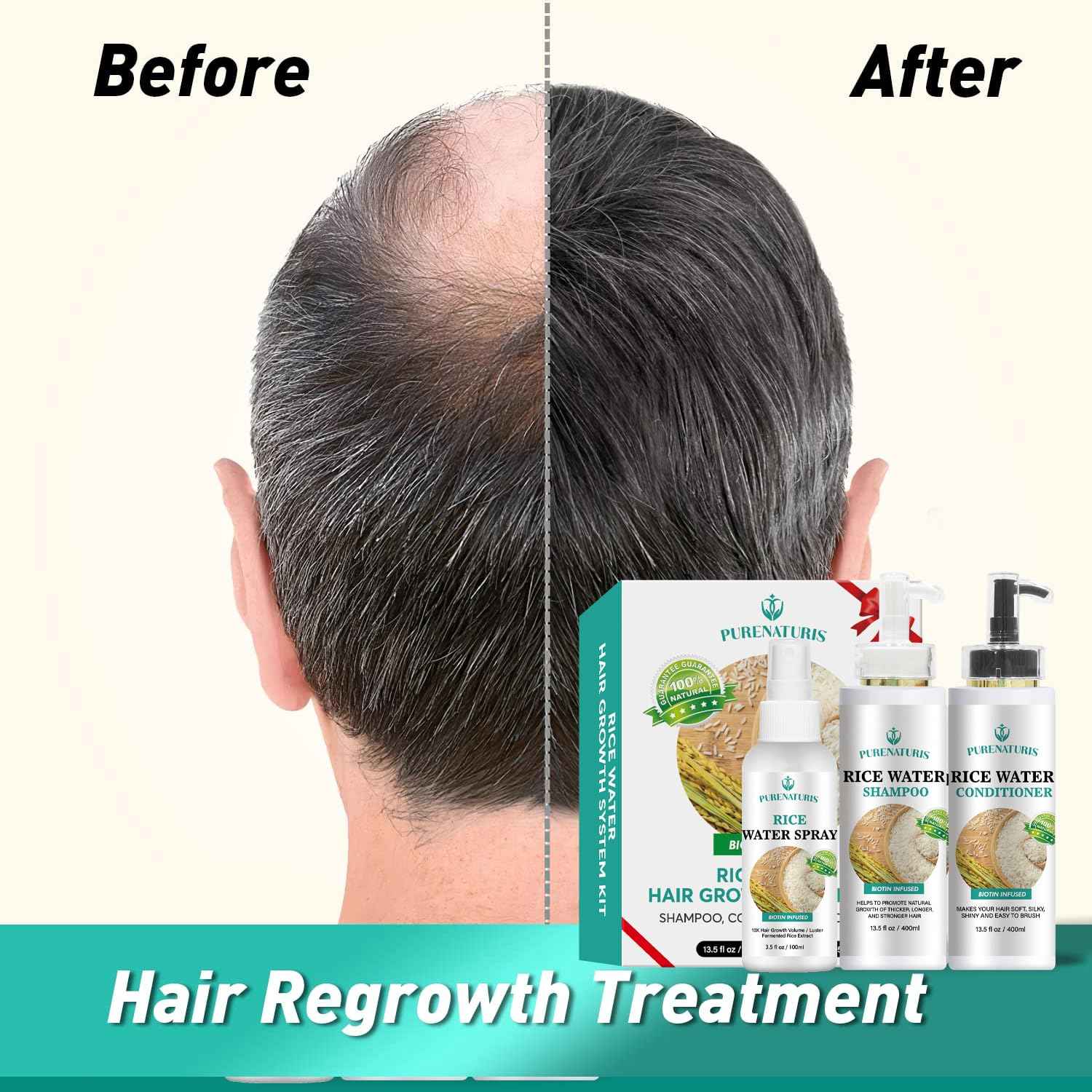 PureNaturis Rosemary Rice Water Shampoo Conditioner & leave-in Spray for Hair Growth Repair System Kit, w/Rosemary, Biotin, Caffeine, Sulfate Free Routine Shampoo for Women Men Hair Loss Thickening