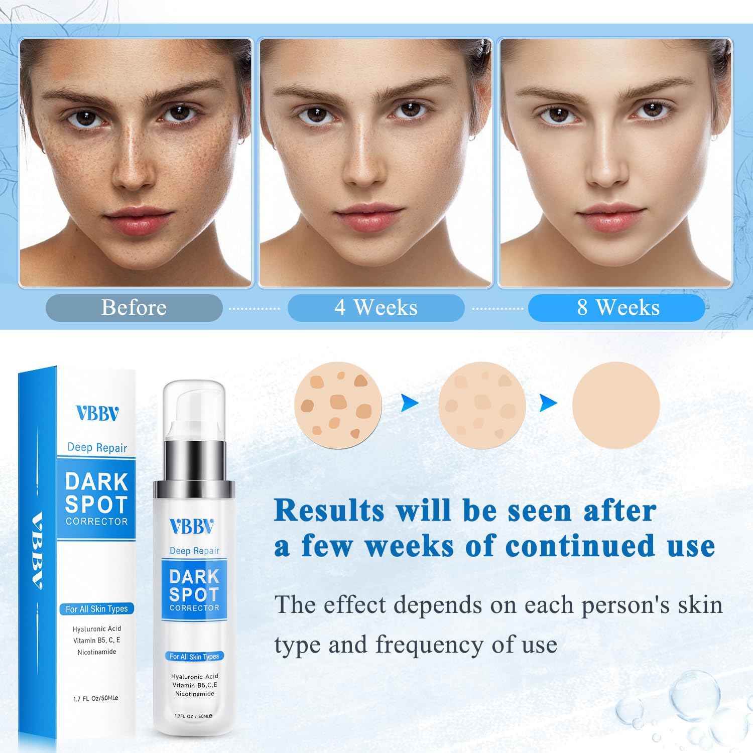 Dark Spot Remover for Face and Body, Dark Spot Corrector, Age Spot Sun Spot Freckles Dark Spot Remover, Melasma Treatment for Face, Advanced Skin Care Cream for Women and Men