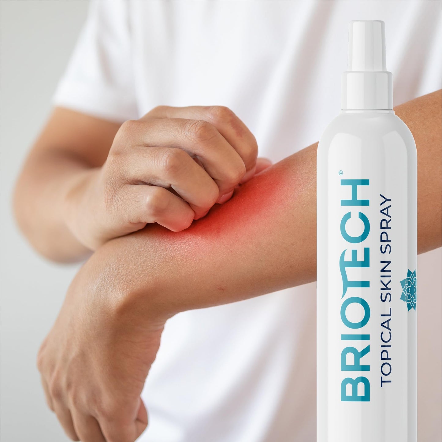 BRIOTECH Topical Skin Spray, Hypochlorous Acid Spray for Body & Face, Eyelid Cleanser, HOCl Facial Mist, Support Against Irritation, Calm Redness, Soothe Foot & Scalp, Packaging May Vary, 4 oz, 1 ct