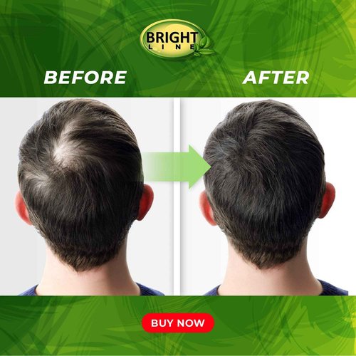 Bright Line Hair Growth Serum - Anti-Hair Loss and Regrowth Treatment for Dry, Damaged Hair and Scalp