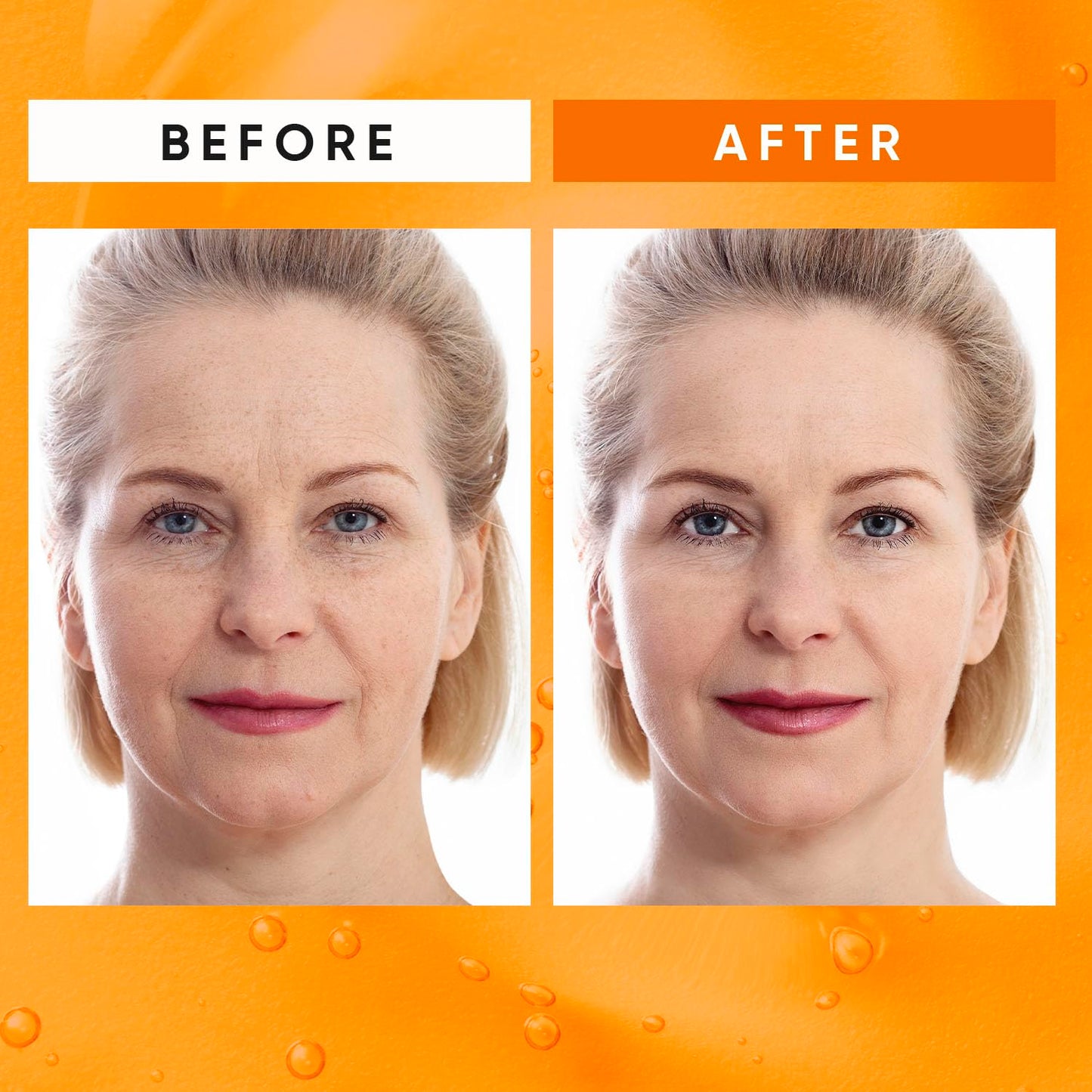 Super Vitamin C Serum for Women Over 70: Advanced Anti-Aging Formula with Vitamin C, Niacinamide, Hyaluronic Acid, Vitamin E, and Caffeine - Hydrating, Lifting, Wrinkle & Dark Spot Reduction