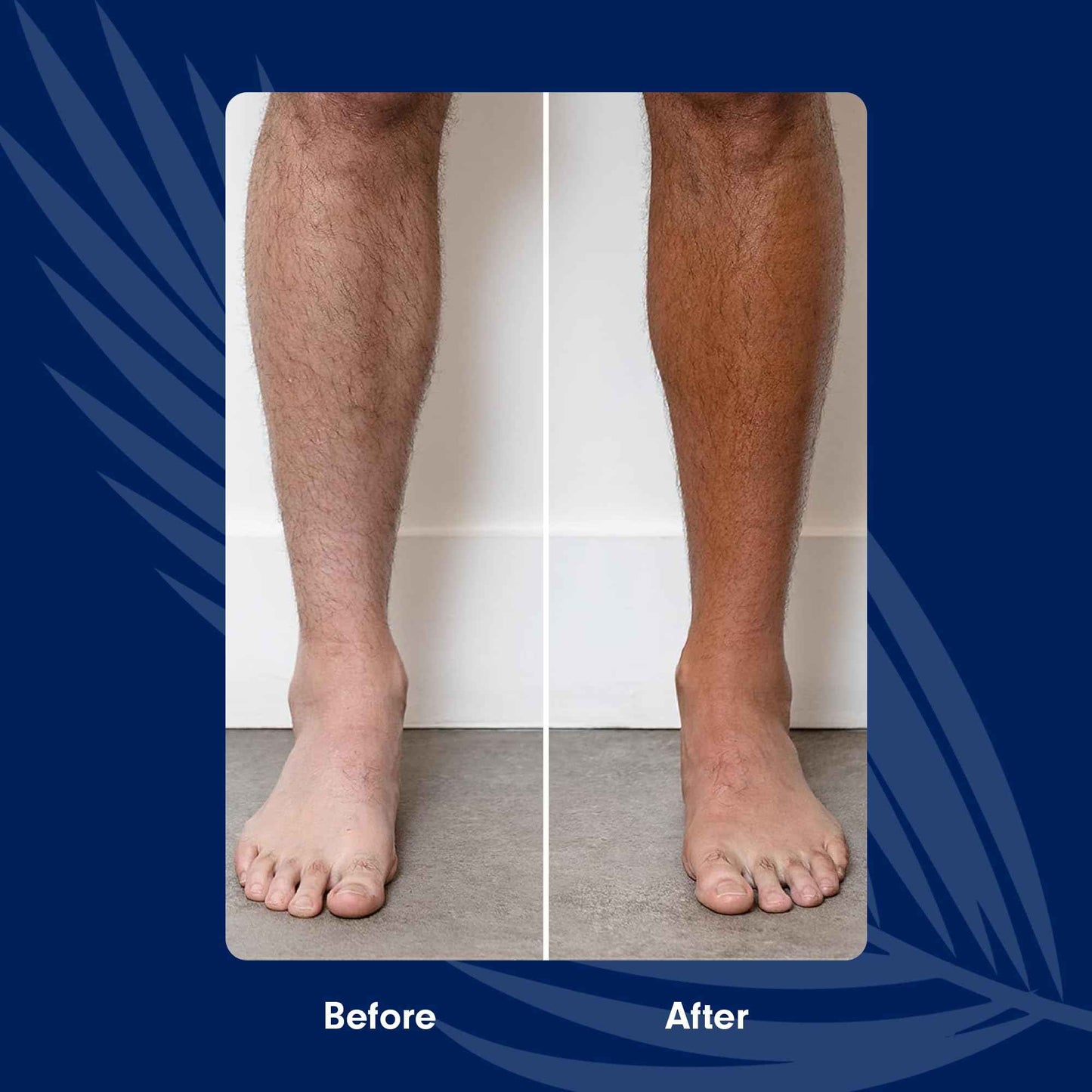 Toma's Total Tan Self-Tanning Lotion Instant Self Tanner - Whole Body Natural Looking Golden Bronze - Non-Sticky Streak-Free Application for Women & Men - Paraben-Free, Cruelty-Free - 6 oz