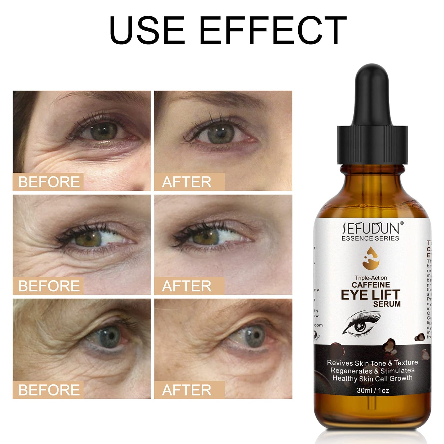 Caffeine Eye Serum Caffeine Eye Lift Serum for Puffy Eyes and Dark Circles Treatment Caffeine Eye Cream for Puffy Bags Under Eye with EGCG Vitamin C (30ml)