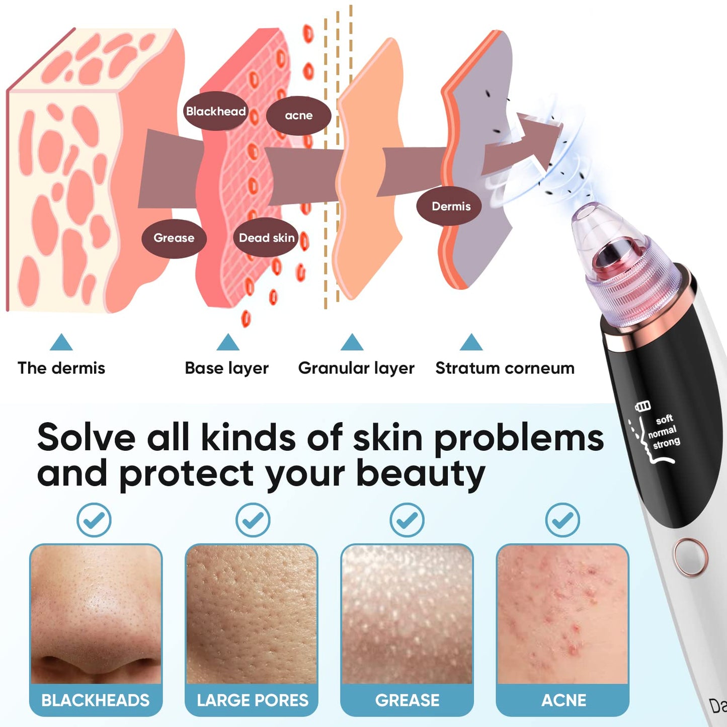 Daweir Blackhead Remover Pore Vacuum - Pimple Extractor Tools Pore Cleaner toolfor Face & Nose