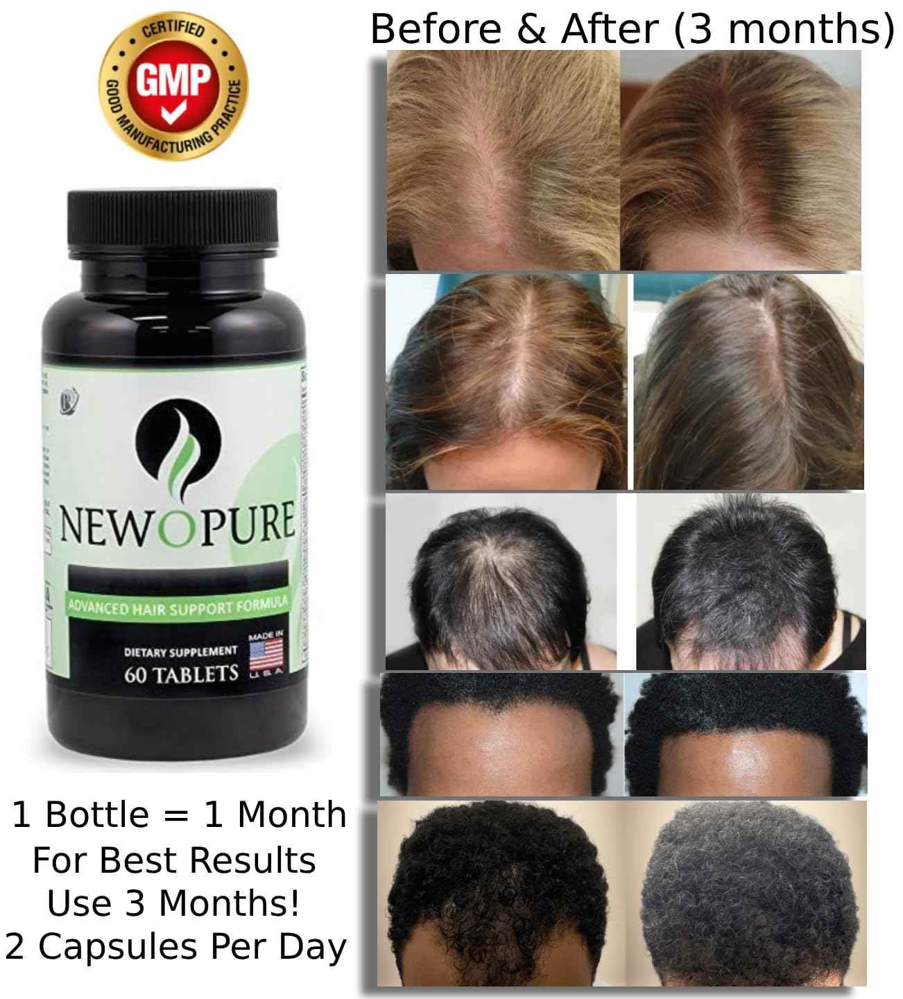 Newopure: Natural Hair Growth Vitamins, Stops Hair Loss, Regrows Hair, Blocks DHT, Stimulates New Growth, Promotes Thicker and Fuller Hair. Men & Women (30 Day Supply)