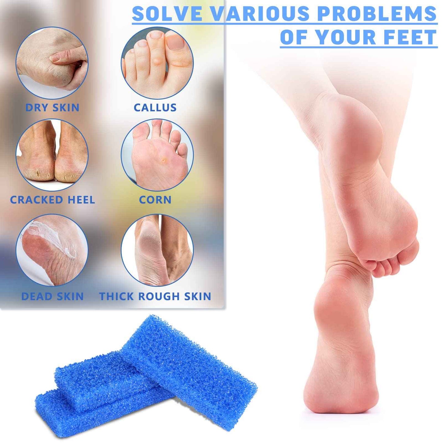 Therwen 400 Pcs Disposable Pumice Stone for Feet Blue Foot Scrubber Dead Skin Callus Remover for Salon Spa Home