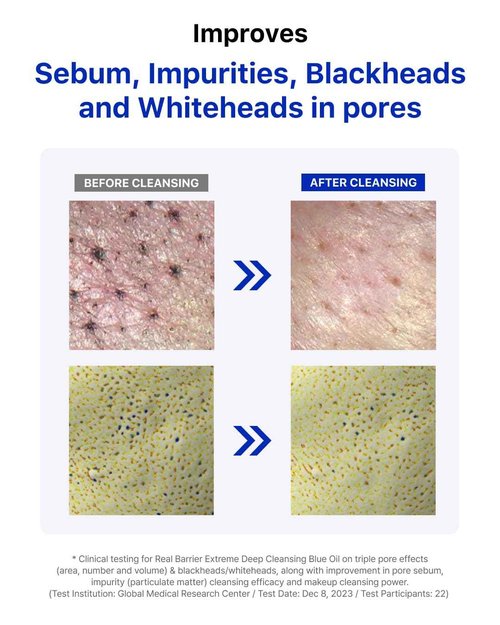 Real Barrier Extreme Deep Cleansing Blue Oil 6.76 Fl Oz, Removes Makeup, Sebum & Blackheads, Hydrating & Gentle on Skin, Low-Irritation Pore Cleansing, Korean Skincare