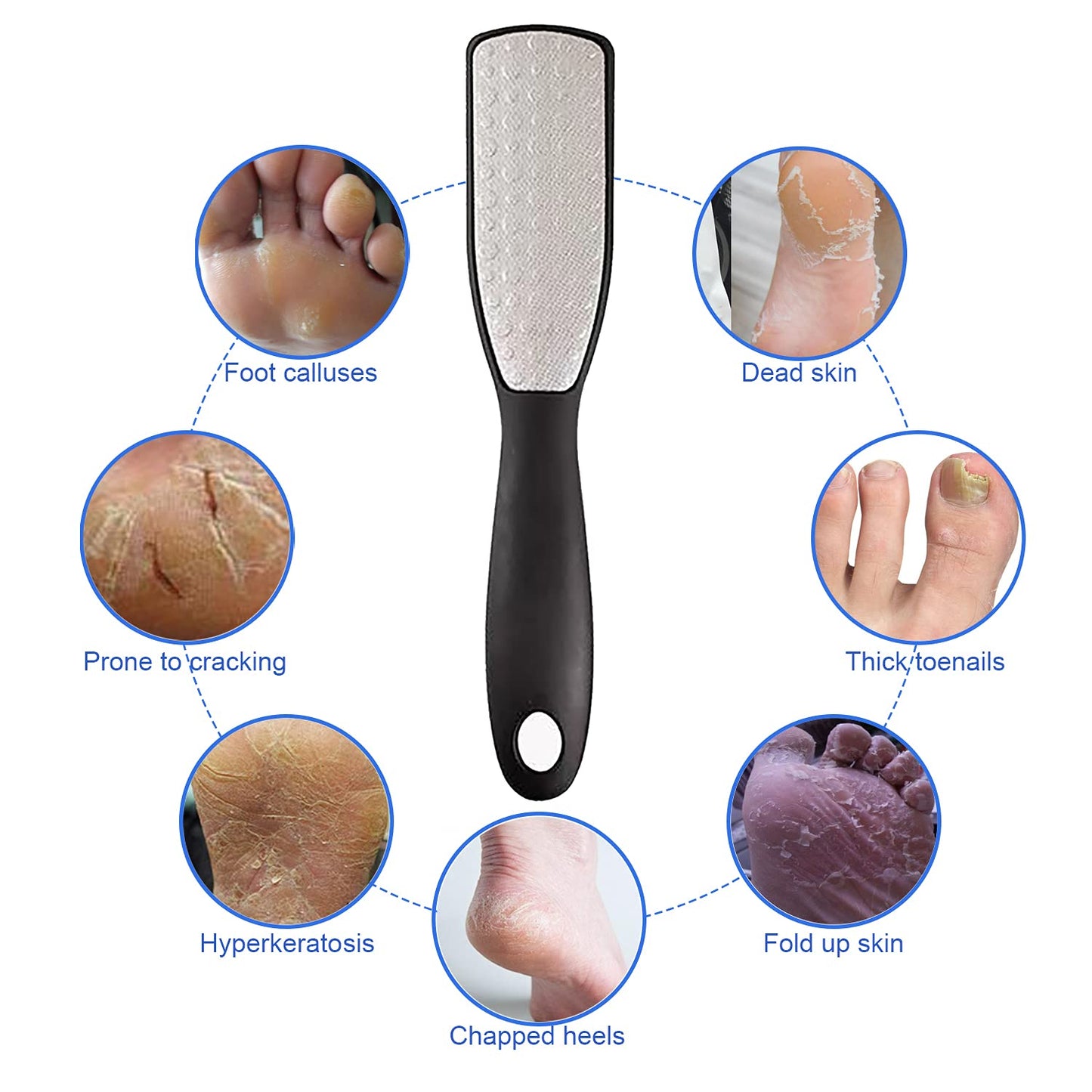 Fanzbike Foot Rasp Foot Files Callus Remover - Professional Foot Care Pedicure Stainless Steel File to Removes Hard Skin (Double-Sided flattop)