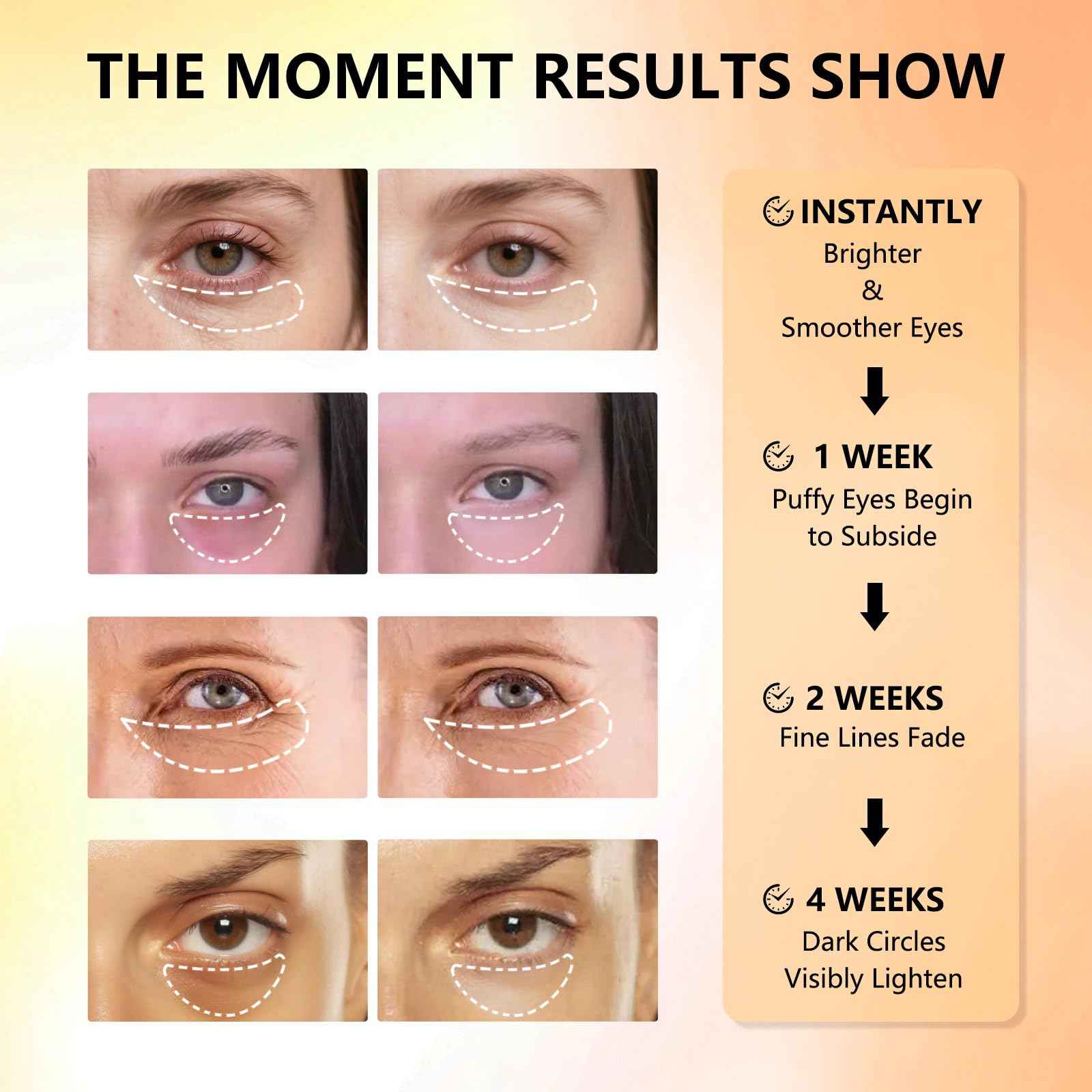 Aeryea Under Eye Patches with Vitamin C & Caffeine 30 Pairs for Dark Circles, Fine Lines and Puffiness, with Niacinamide Hydra-Gel Collagen, Skin Care for Men & Women