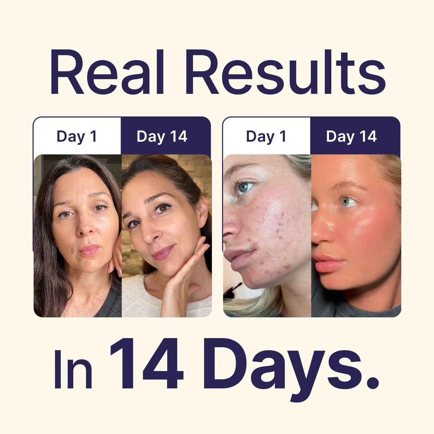 Tallow and Manuka Honey Balm, 2 oz, Unscented, Grass Fed Grass Finished, Face Cream, Body, Lotion, and Lip Balm