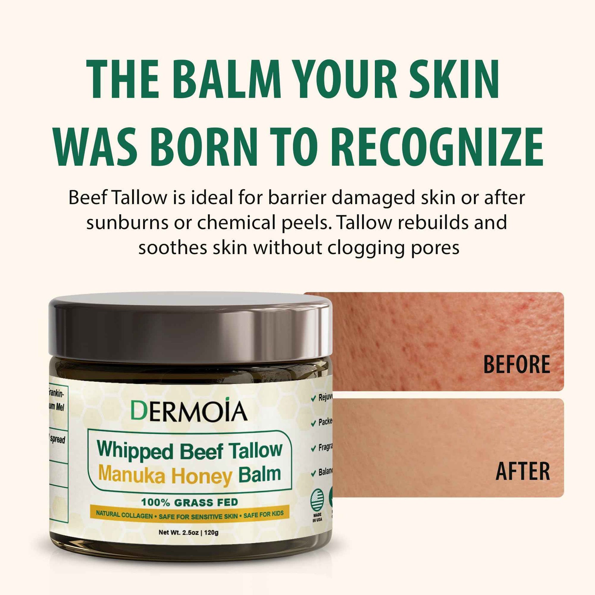 DERMOIA Grass Fed Whipped Beef Tallow for Skin with Manuka Honey - Silky Smooth, Fast Absorbing Tallow & Honey Balm - Ideal for Kids & Eczema Prone Area - Whipped Moisturizer for Dry & Sensitive Skin