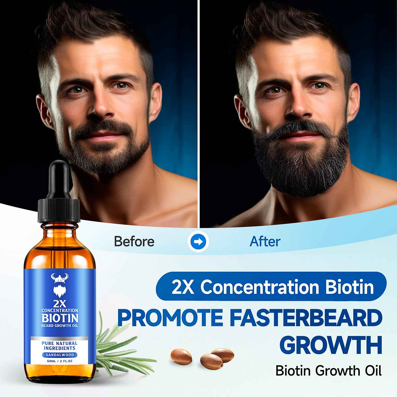 Beard Growth Oil - 2X Concentration Biotin Beard Oil for Men (2 oz) - Natural Mens Beard Oil with Argan Oil, Jojoba Oil and Vitamin, Beard Growth Softener, Moisturizer (Sandalwood)
