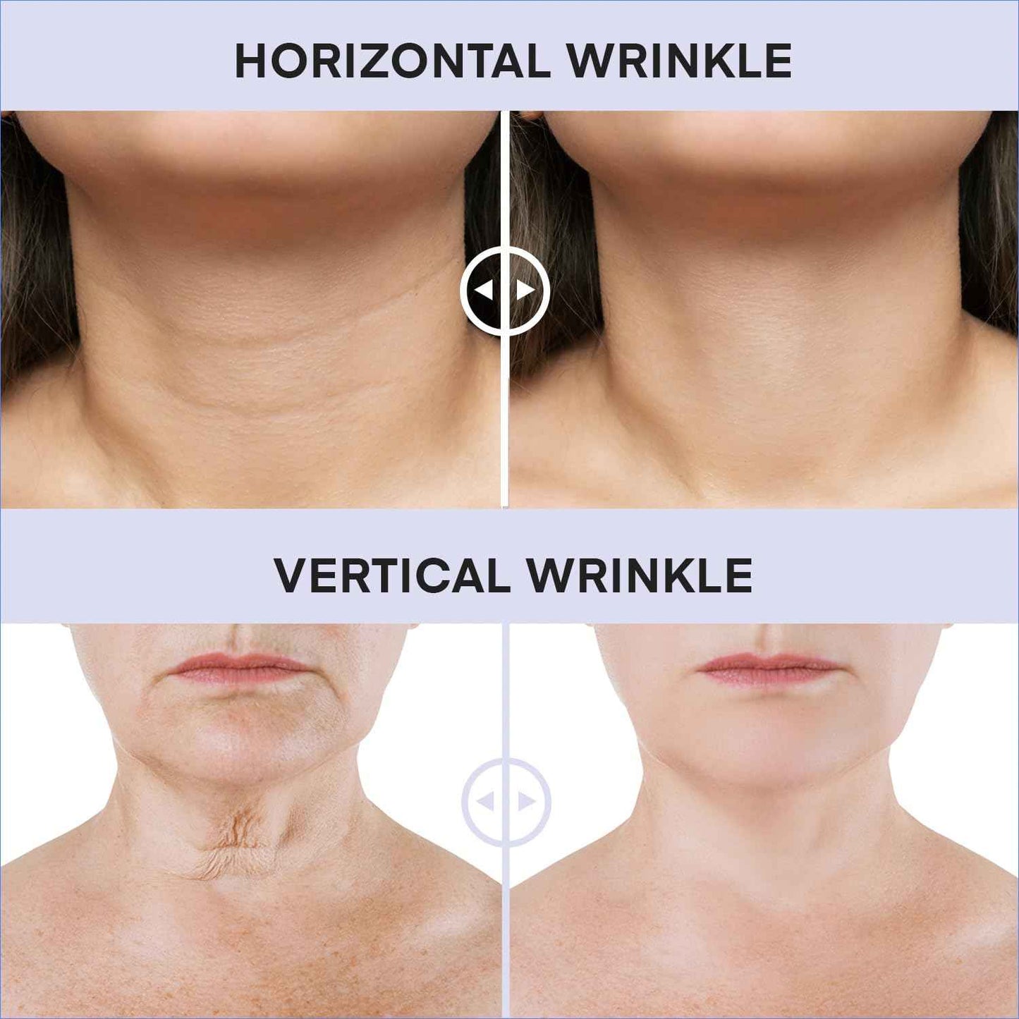 DERPHEA Neck Cream For Tightening And Firming: Advanced Neck Tightening Cream - Tighten And Lift Neck Cream For Wrinkle & Fine lines - Loose & Sagging Skin On Face, Neck, Chest & Decollete - 3.4 Oz