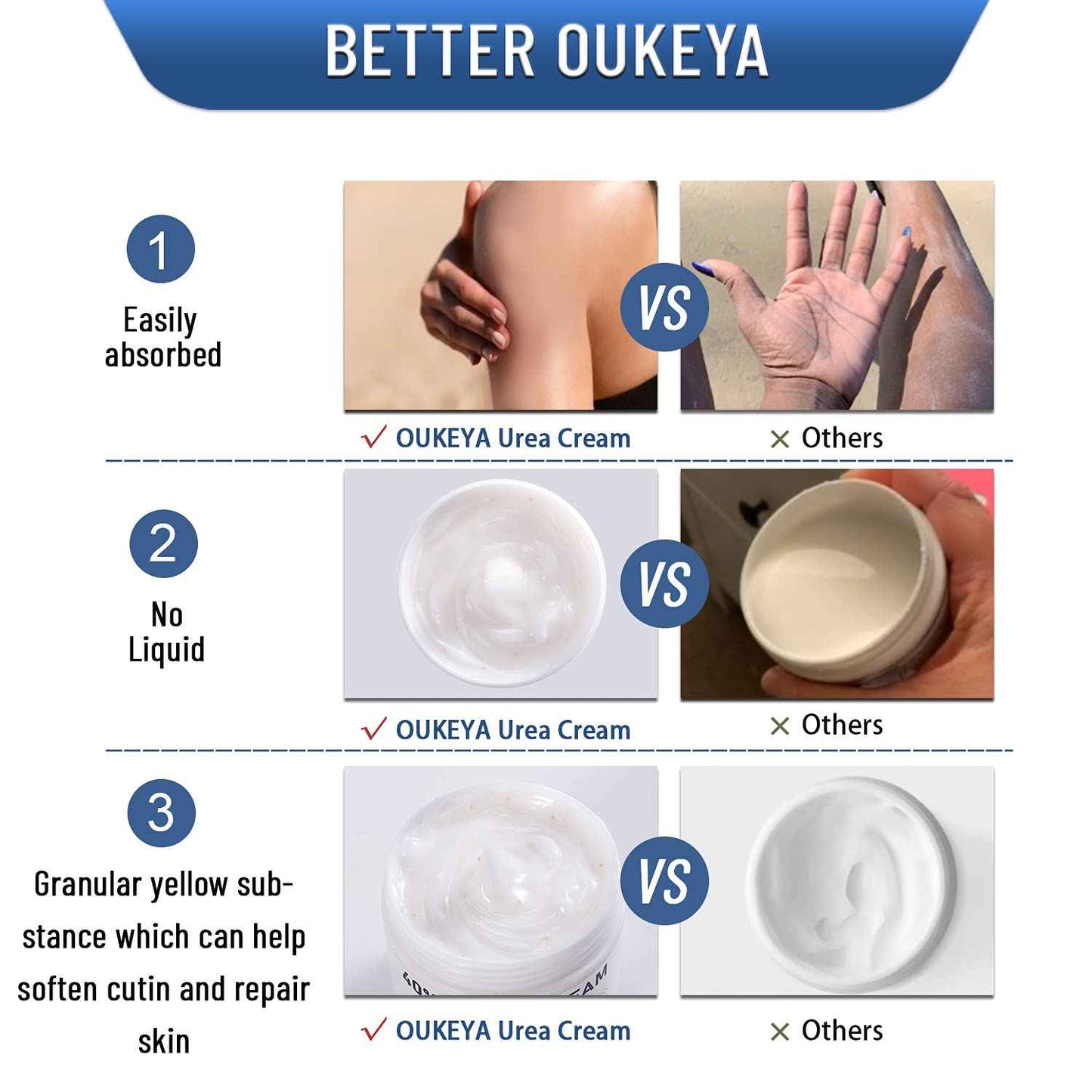 OUKEYA Urea Cream 40 Percent,Foot & Hand Cream for Dry Cracked,Urea Lotion for Feet Maximum Strength(4 Packs)