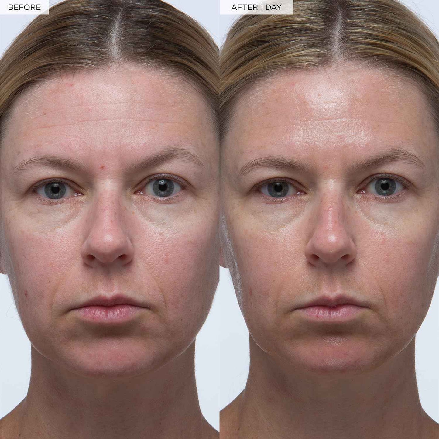 Glow Recipe Plum Plumping & Hydrating Hyaluronic Acid Korean Skin Care Serum - Antioxidant Anti Aging Face Serum + Vitamin B5 for Lasting Skin Barrier Repair & Firming Lines & Wrinkles - Vegan, 30ml