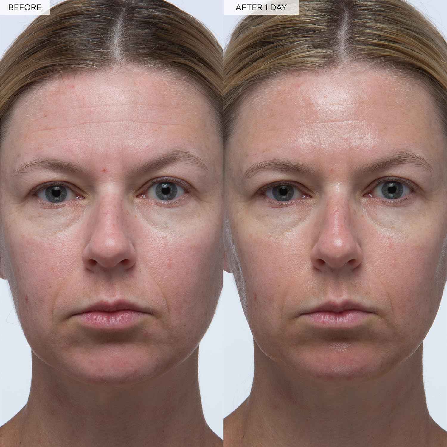 Glow Recipe Plum Plumping & Hydrating Hyaluronic Acid Korean Skin Care Serum - Antioxidant Anti Aging Face Serum + Vitamin B5 for Lasting Skin Barrier Repair & Firming Lines & Wrinkles - Vegan, 30ml