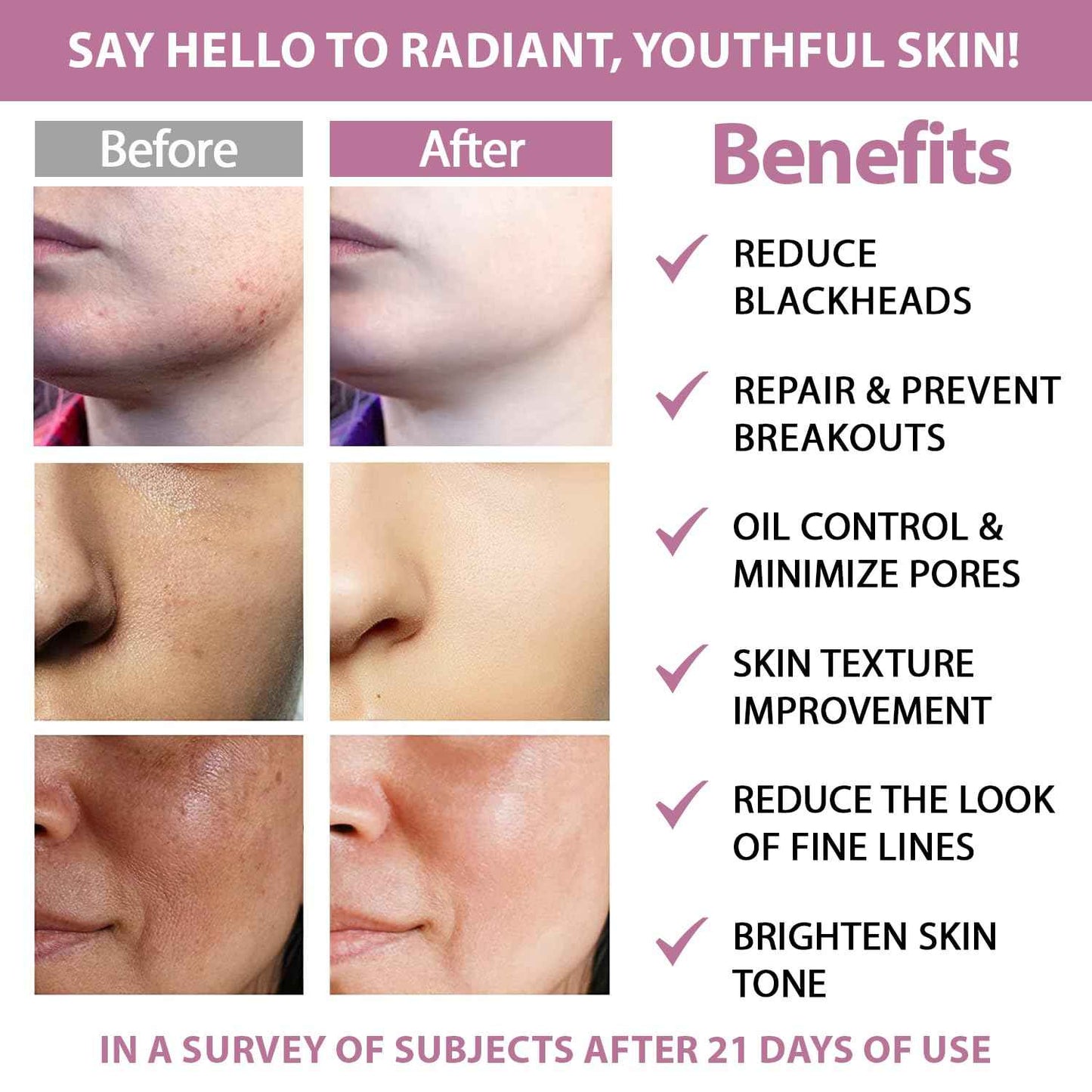 Glycolic Acid 20% & Salicylic Acid 2% Face Exfoliating Pads (50 Count)- Facial Peel Pads for Anti-Aging, Cleansing, Resurfacing, Brightening, Blemish Control, Revealing Clear, Glowing, Youthful Skin