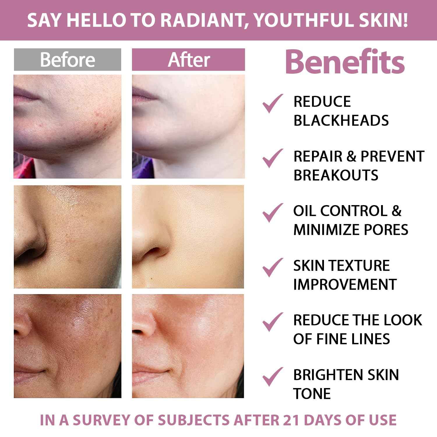 Glycolic Acid 20% & Salicylic Acid 2% Face Exfoliating Pads (50 Count)- Facial Peel Pads for Anti-Aging, Cleansing, Resurfacing, Brightening, Blemish Control, Revealing Clear, Glowing, Youthful Skin