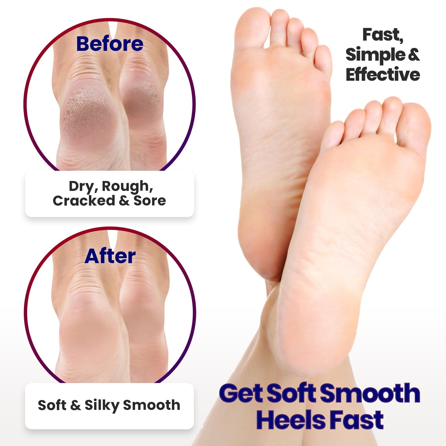 Moisturizing Socks for Women & Men | Aloe Vera Cracked Heel Treatment | Foot Callus Remover | Aloe Socks for Cracked Heels & Dry Cracked Feet | Lotion Infused Gel Heel Socks (Fits Most - 2 Pairs)