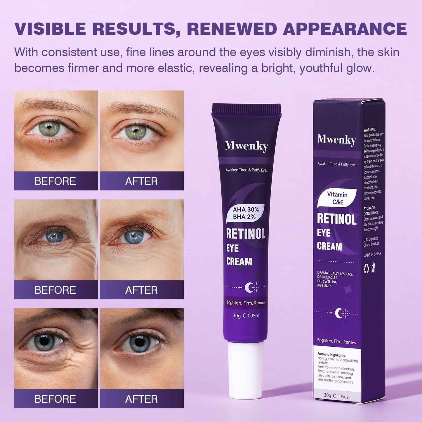 Retinol Eye Cream, Infused with Vitamin C&E to Smooth and Hydrate Skin, Cream for Dark Circles Treatments, Reduce Under, Smooth Wrinkles, Eye Bags, Puffiness