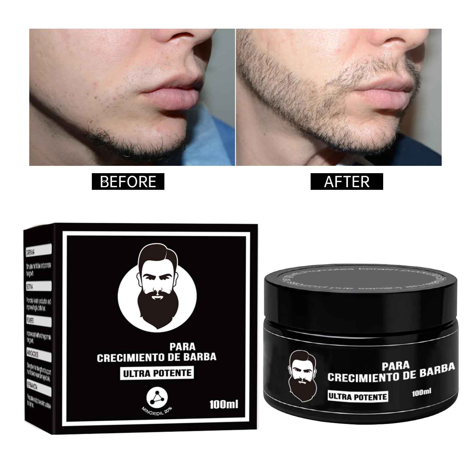 Estimulante Para Barba – Bálsamo de Crecimiento Ultra Potente, Barba Crema, Beard Growth Balm, Moisturizes & Strengthens Beard, 100 ml / 3.5 oz(3PC)