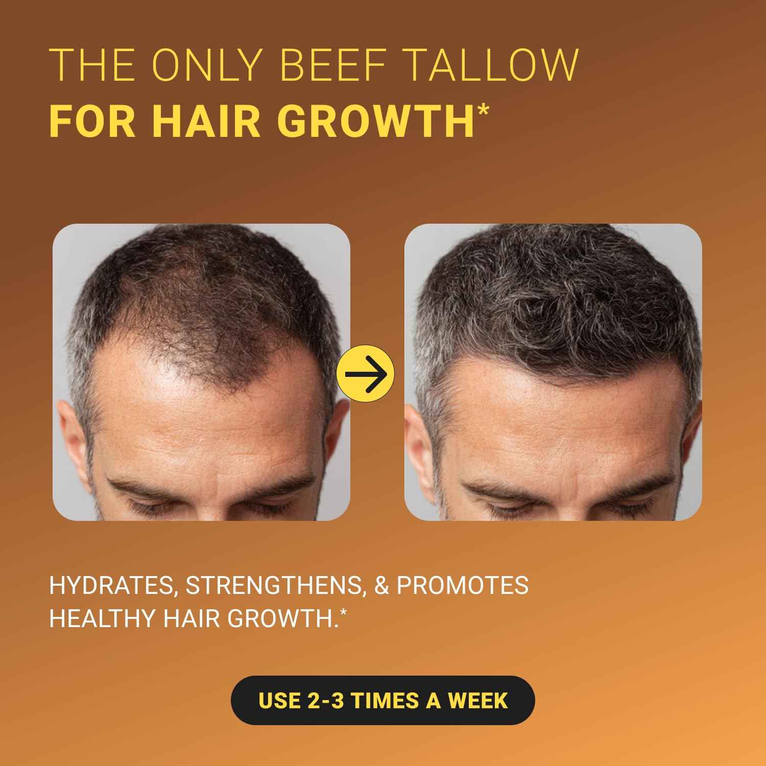 Non-Greasy Beef Tallow for Skin &Hair 5OZ Shea Butter, Vitamin E, Niacinamide, Whipped Grass Fed Beef Tallow for Face Moisturizer Cream, Lotion for Women & Men, Anti-Aging Face Moisturizer Leyo Rujera