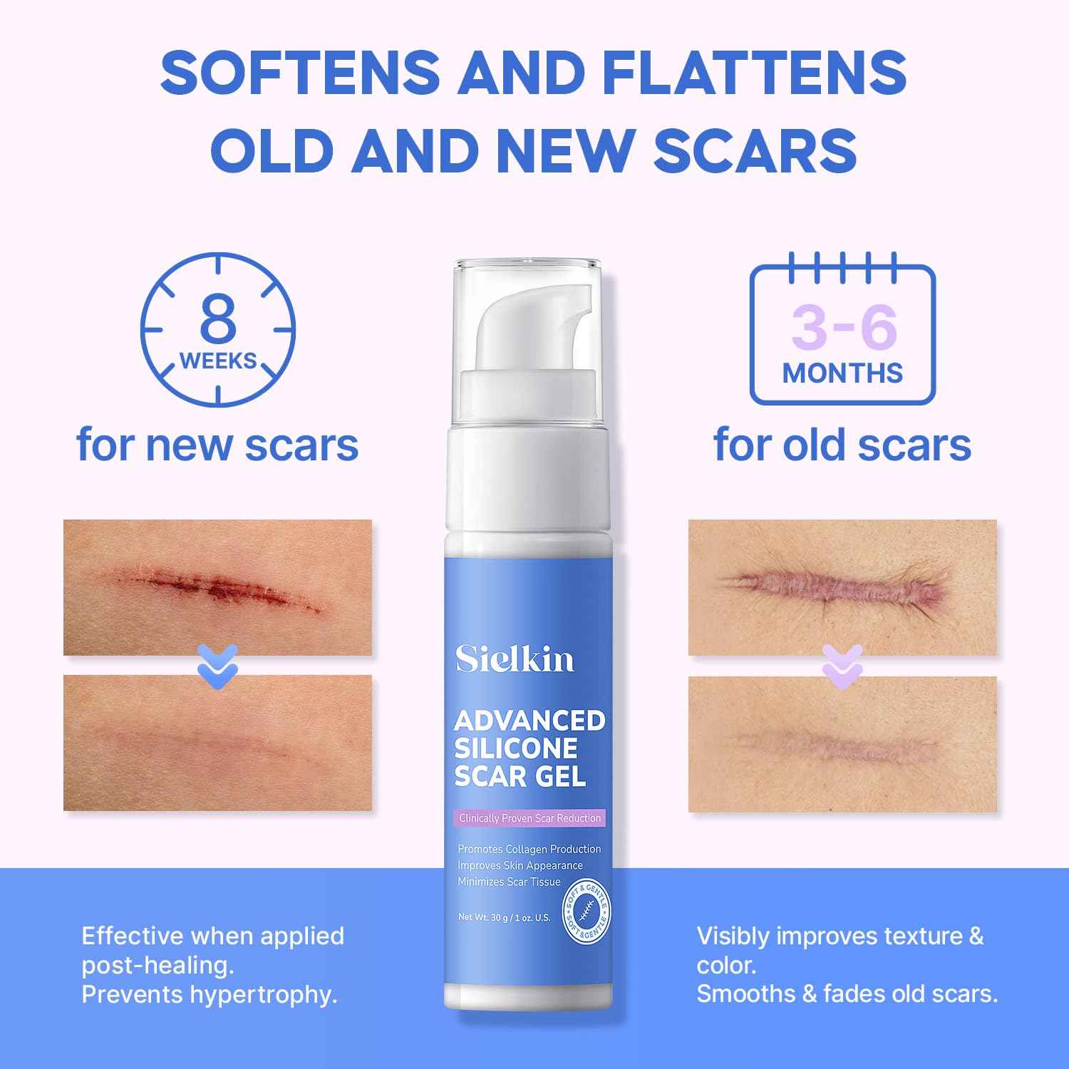Medical Grade Silicone Scar Gel: Old and New Scars Removal Cream - Intensive Fade Surgical & C-Section Scars, Stretch & Acne Marks, Injury, Burns, Keloids, 30g, 2 Scar Sheets