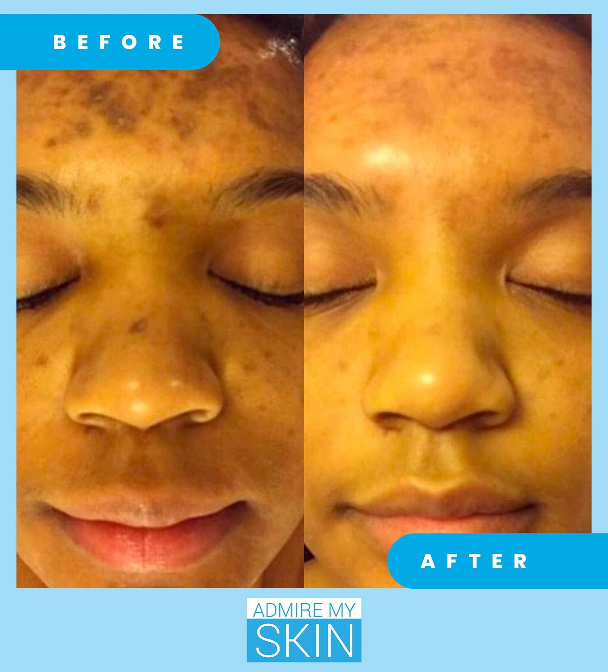 Admire My Skin Dark Spot Corrector Serum + Retinoid Cream Set