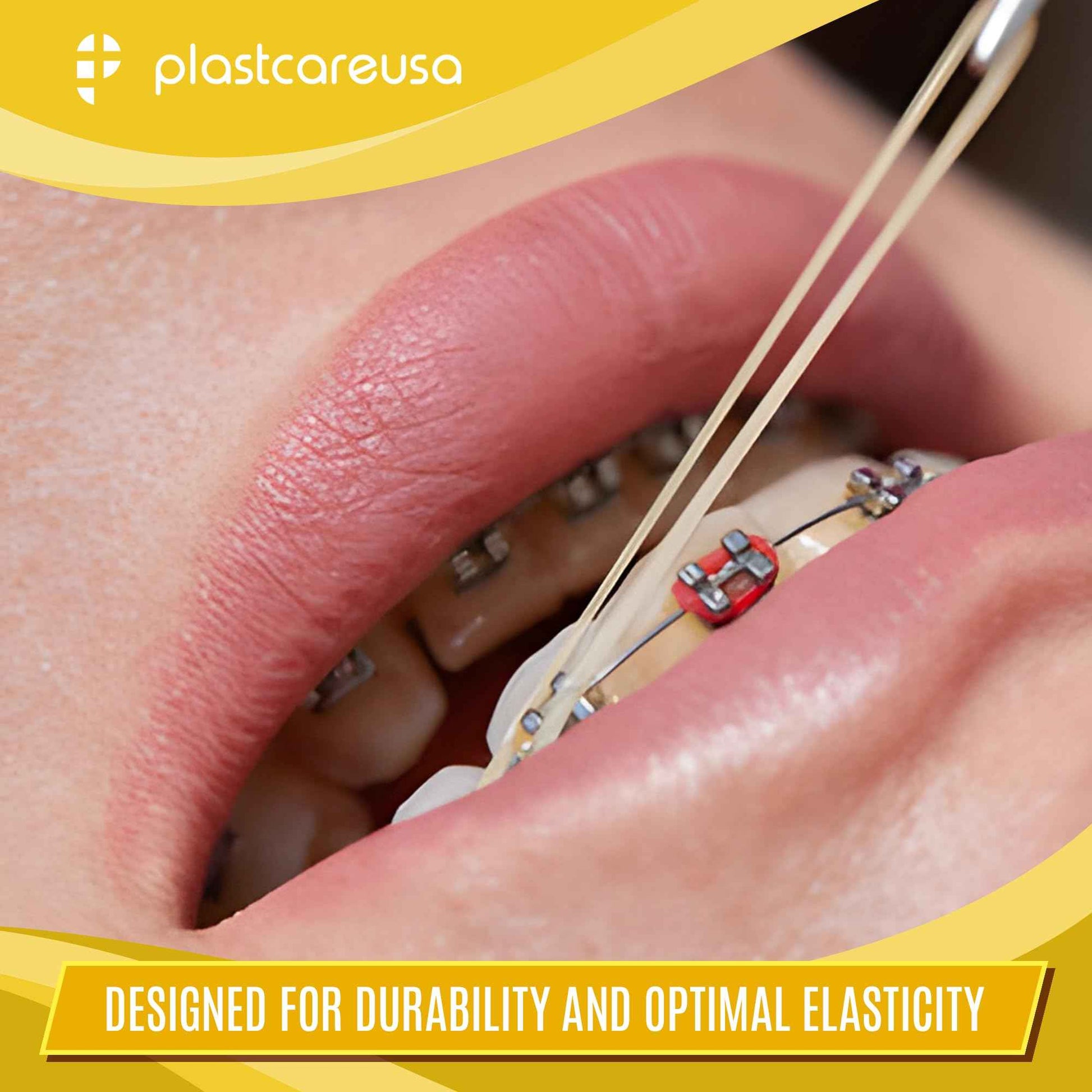 1000 (3/16" Rabbit, Heavy 6.5 Oz) Orthodontic Latex Elastic Rubber Bands for Braces - Multi-Size Dental Elastics Kit, Heavy-Duty Ortho Bands for Gap Closure & Teeth Alignment (10 Bags of 100)