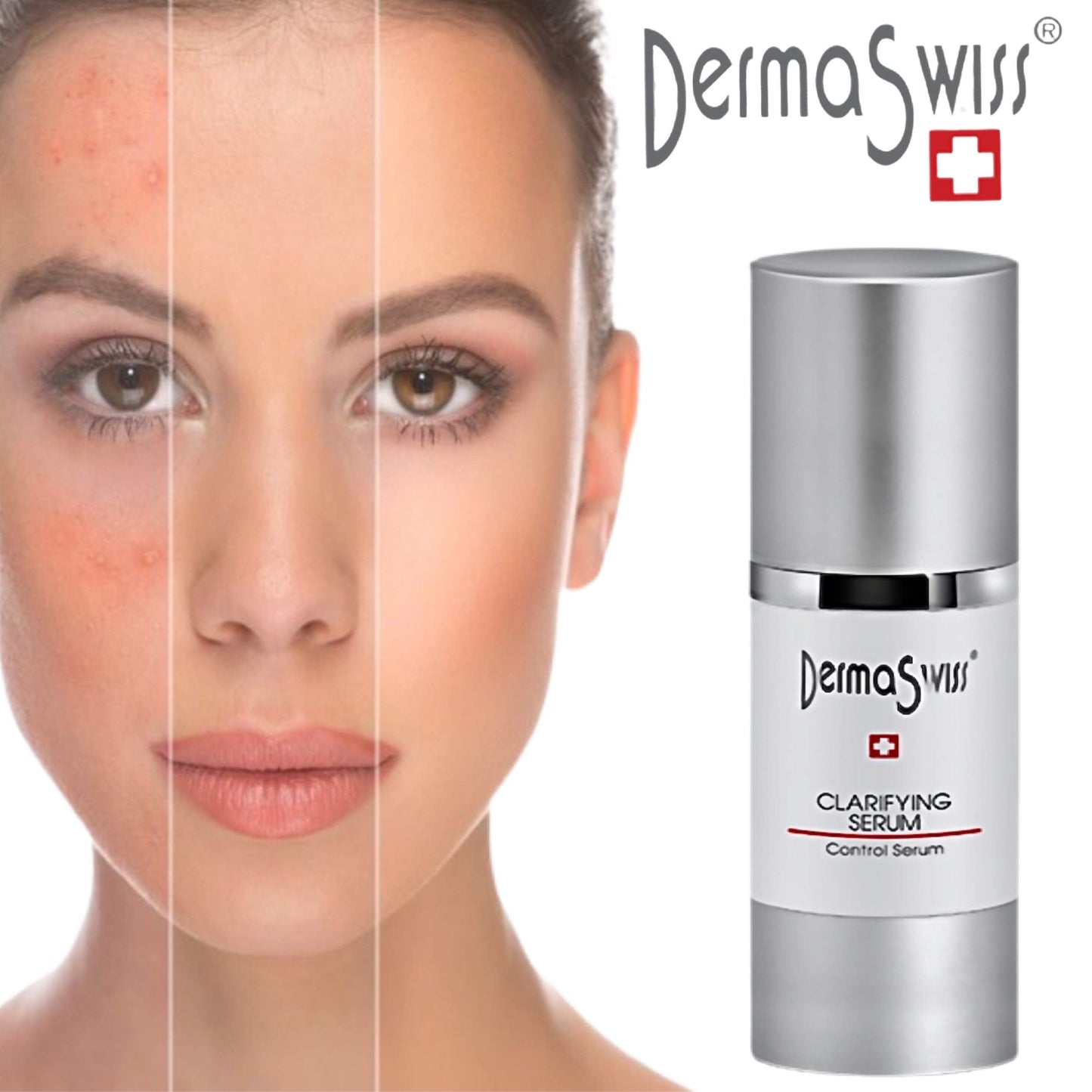 Clarifying Face Serum - Derma Swiss Control Skincare Clarity- Acne Spot Treatment Essential Serum for Day and Night with Probiotics, Moisturizer Skin.