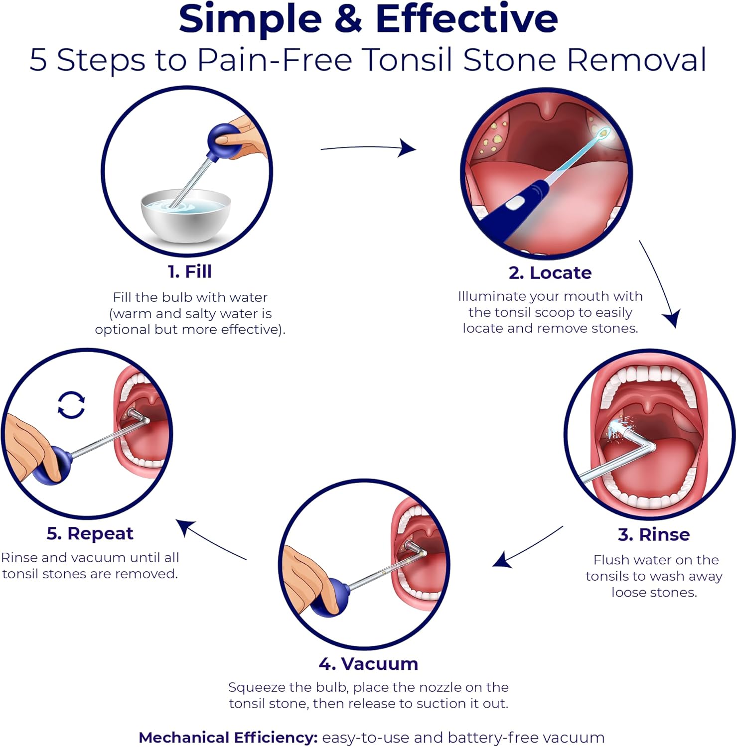 Oravix Tonsil Stone Vacuum, Tonsil Stone Remover Vacuum Suction, Tonsil Stone Cupping Tool, Tonsil Stone Removal Tool with Suction, Tonsil Stones Removal Vacuum, Tonsil Stone Extractor - 3 in 1 Kit