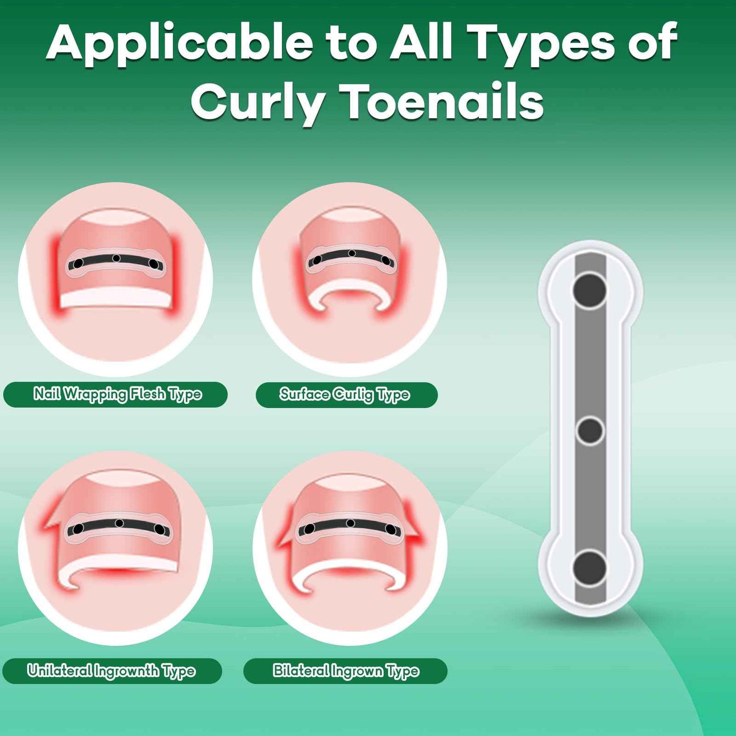 Titanium Alloy Ingrown Toenail Corrector New Version Ingrown Toenail Removal Tool Kit, Designed for Curved Nail Repair Big Toe Ingrown Toenail