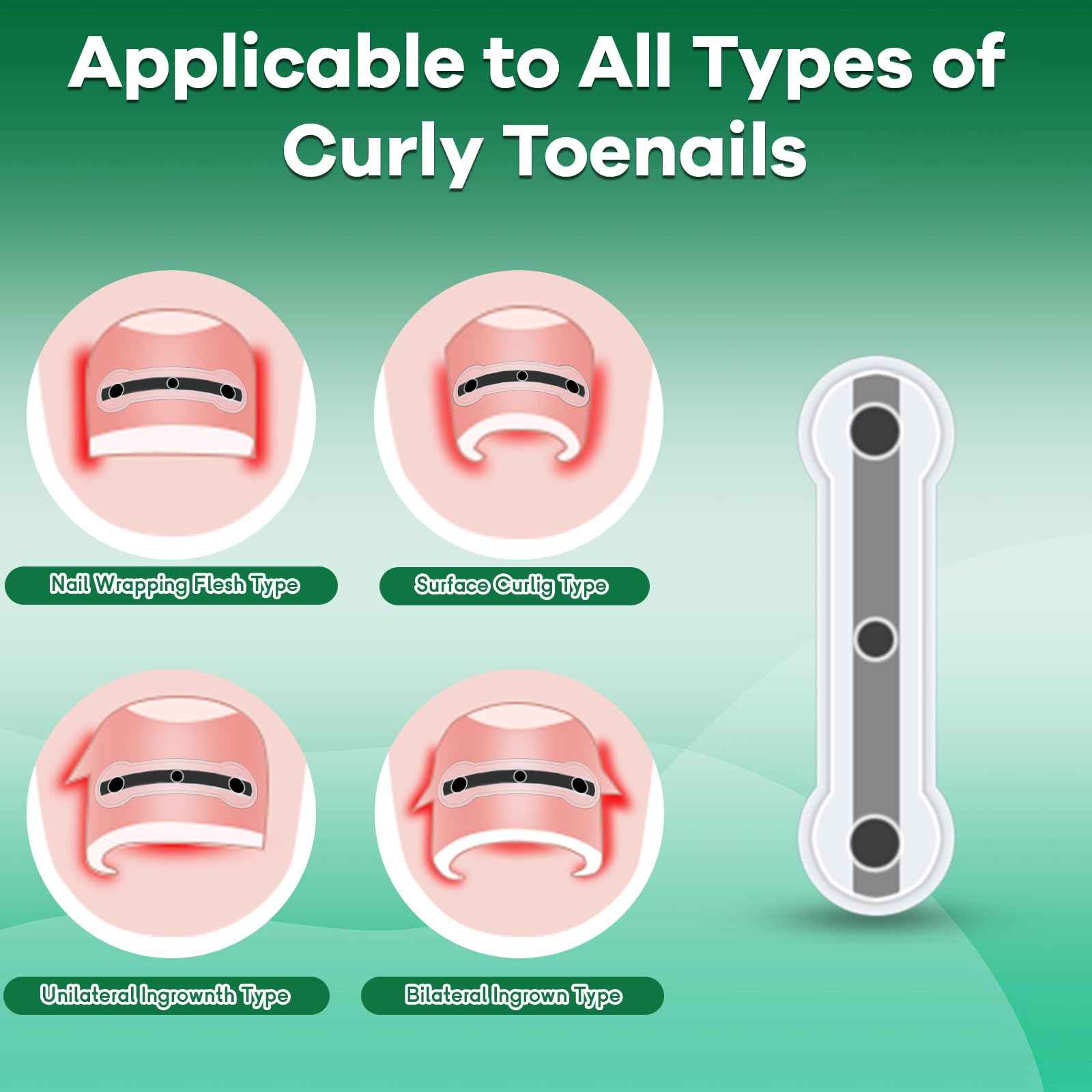 Titanium Alloy Ingrown Toenail Corrector New Version Ingrown Toenail Removal Tool Kit, Designed for Curved Nail Repair Big Toe Ingrown Toenail