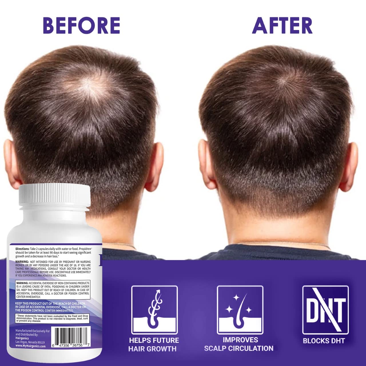 Propidren by HairGenics - DHT Blocker & Hair Growth Capsules to Prevent Hair Loss & Stimulate Hair Follicles, to Stop Hair Loss & Regrow Hair. Proprietary Anti-Hair Loss & Hair Regrowth Treatment.