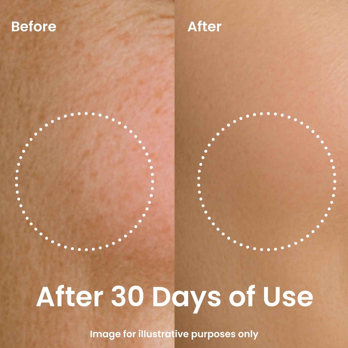 Feat by You - ViTassie CICA Refreshing Gel Cream (2.7 FL OZ) Face Moisturizer for Dry Skin, Acne-Prone, Sensitive Skin with Vitamin C, Centella Asiatica, Niacinamide, Hydrating, Soothing, Korean Made