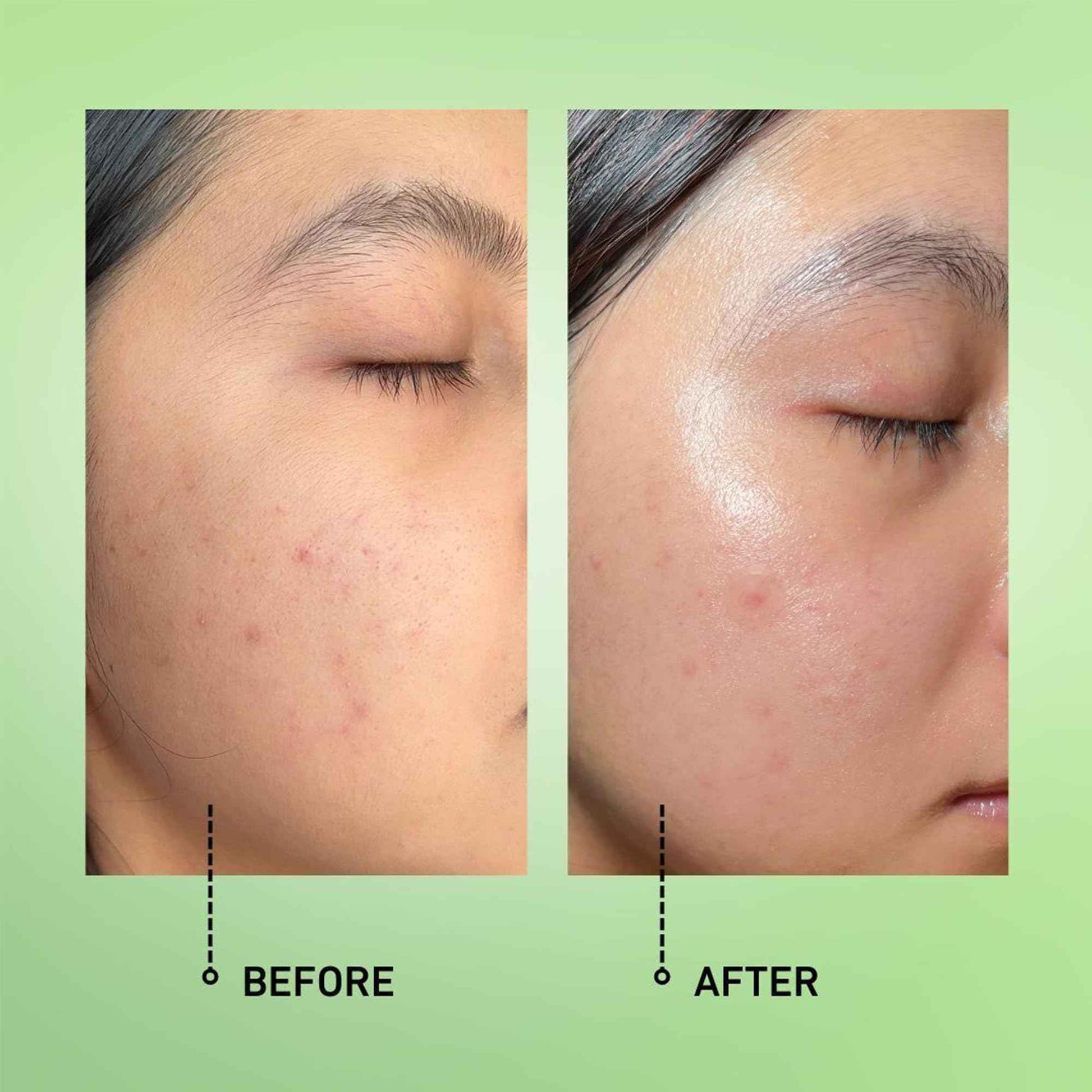 good light Alphabet Oil. Lightweight & Non-Greasy For Oily, Acne Prone Skin. Use Daily For Face, Neck, Chest, & Hands. Made With Vitamin C, Vitamin E, and Jojoba Oil. Vegan Korean Skin Care, 1 Fl. Oz.