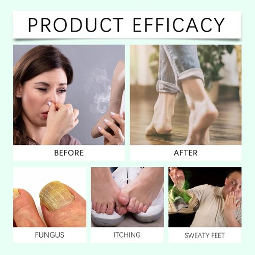 Foot Sanitizer Spray with Tea Tree Oil, Foot and Nail Care Serum, with Natural Tea Tree Oil and Aloe Vera Feet Spray, Nail Solution and Foot Sanitizer Spray with Tea Tree Oil (1pc)