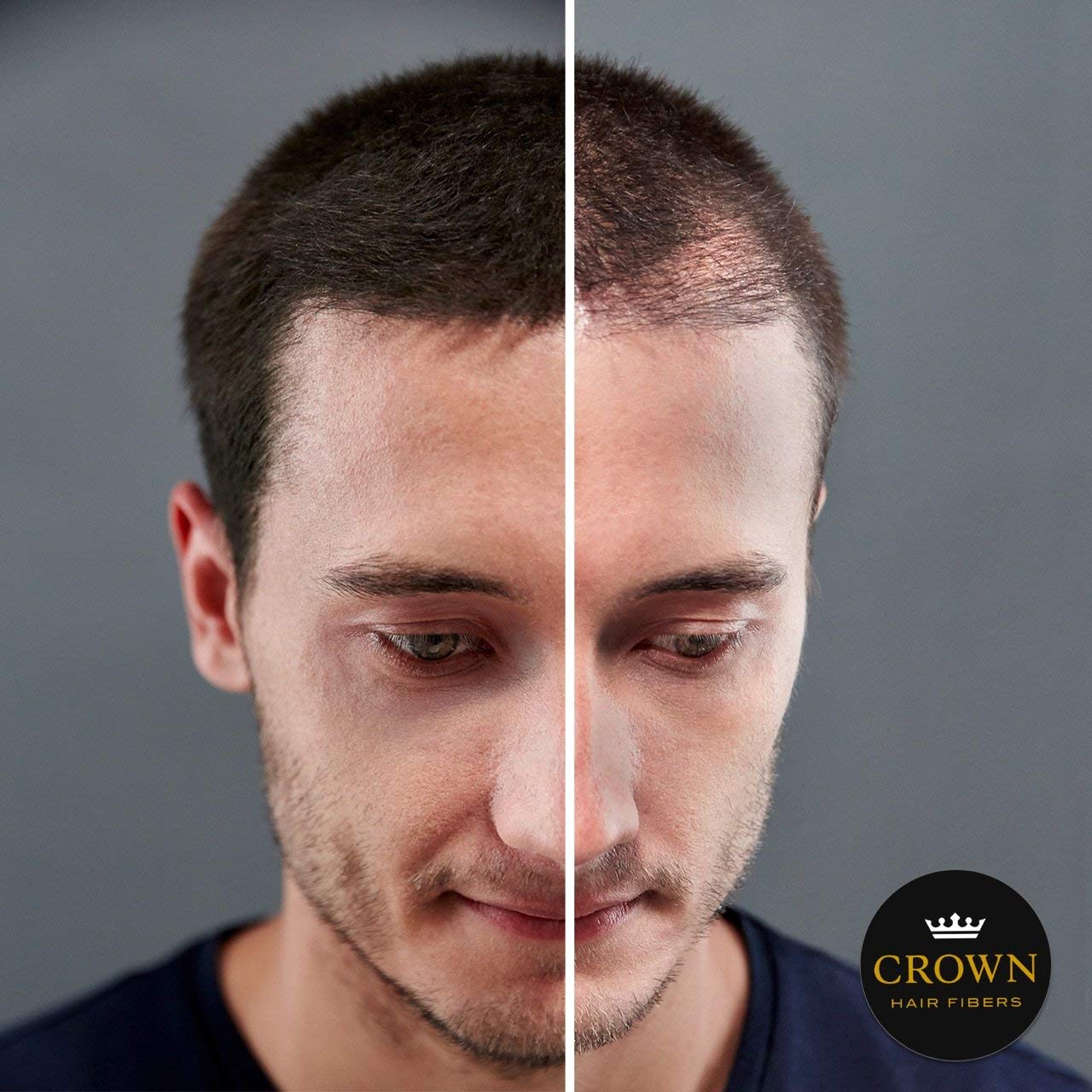 CROWN HAIR FIBERS for Thinning Hair (BLACK) - Instantly Thickens Thinning or Balding Hair for Men & Women - 0.87oz/25g Bottle - Best Natural Keratin Hair Loss Concealer