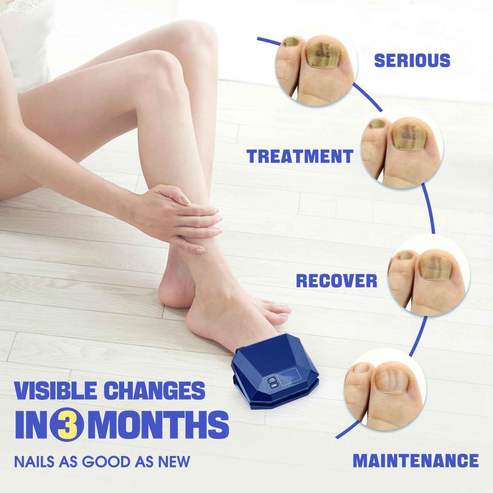 Multifunctional Equipment Blue Device for Toenails and Fingernails, Damaged and Discolored Effective & Reliable