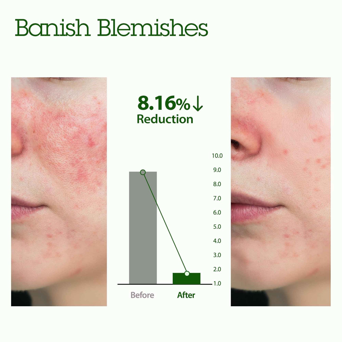 BLITHE Patting Splash Mask Face Exfoliator with Soothing & Healing Green Tea - Lactic Acid Exfoliating Face Wash for Acne Prone Skin, Vegan K Beauty Oil Controlling & Pore Clarifying 5.07 Fl Oz