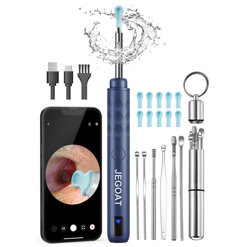 Ear Wax Removal Tool Camera, Ear Cleaner with Camera, Ear Cleaning Kit 1296P HD Ear Scope, 6 LED Lights and 12 Ear Picks, Earwax Removal with Otoscope to Earify Earwax for iOS and Android