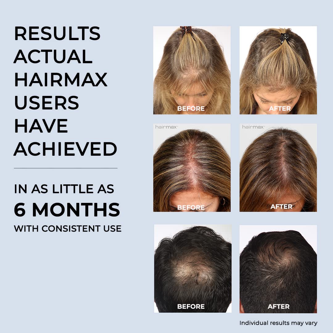 HairMax Ultima 9 Classic LaserComb (FDA Cleared) Hair Growth Device. Stimulates Hair Growth, Reverses Thinning, Regrows Denser, Fuller Hair. Targeted Hair Loss Treatment.