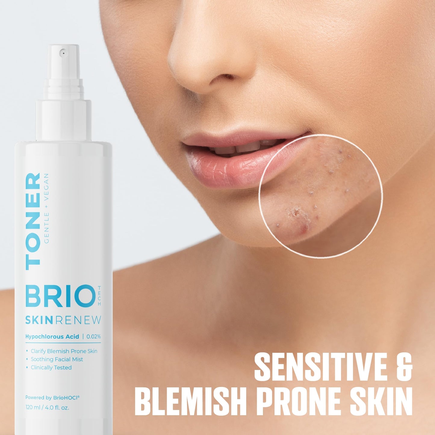 BRIOTECH Skin Renew Toner, Hypochlorous Acid Spray Topical Skin Spray for Face and Skin, Minimize Appearance of Blemishes, Soothing Mist for Redness & Bumps, 4 fl oz